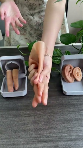 Silicone prosthetic fingers restore confident appearance