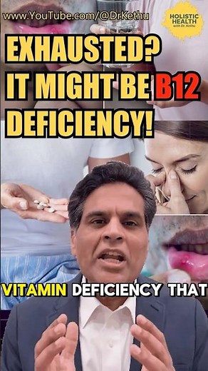 The #1 Reason You're Exhausted: B12 Deficiency (Doctor Explains 3 Symptoms)