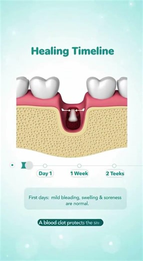 🦷 Is My Tooth Extraction Healing Normally?