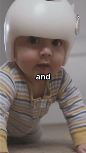 360° Baby Helmet™ Baby Head Protector