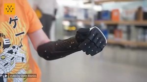 Hero Arm – a prosthetic arm for adults and children Advanced, intuitive, robust and light. The Hero Arm is an affordable advanced multi-grip prosthetic arm, with multi-grip functionality and empowering aesthetics. Engineered and manufactured in Britain, the Hero Arm is a custom lightweight and affordable myoelectric prosthesis, now available in over 801 locations across the US for below-elbow amputee adults and children aged 8 and above. Your limb difference is your superpower. Video credits: Op