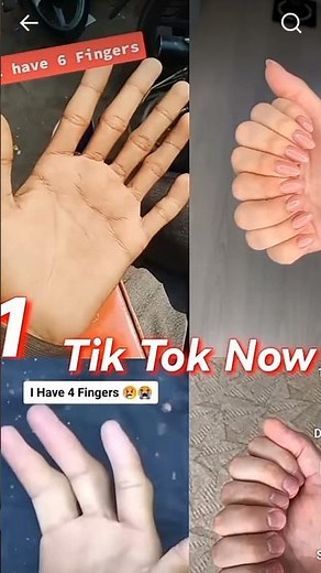 hand trending video #handdance #handtrend #1million #foryou #handvideos #trendingshorts