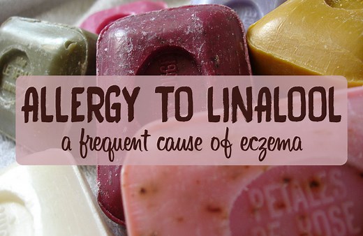 Linalool Allergy: a Frequent Cause of Eczema? What to do?