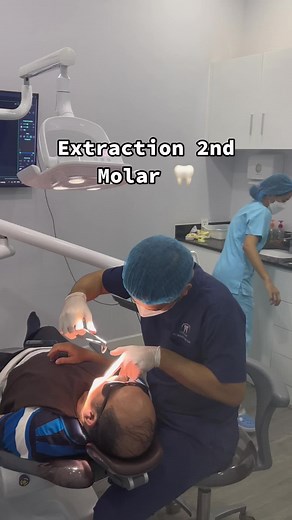 Extraction 2nd Molar 🦷 #fypシ #extraction #cambodia #dentistry #bestdentalclinicincambodia