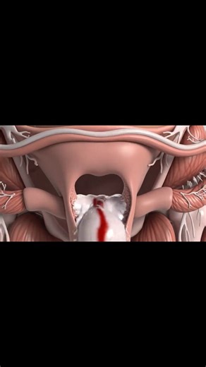 Sachin Singh Negi on Instagram: "White Discharge period First day painfull process inside view #period #process #human #anatomy #foryou"