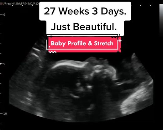 27 Week Pregnancy Ultrasound: Baby Profile & Stretch