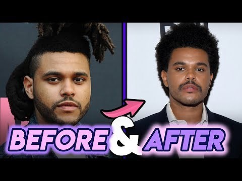The Weeknd | Before And After Transformation | New Hair Style
