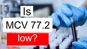 Is MCV 77.2 low, normal or dangerous? What does Mean corpuscular volume level 77.2 mean?