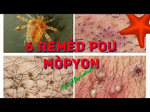 6 remèd pou mòpyon (morpion)