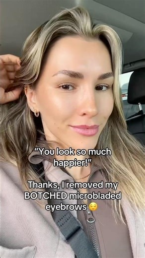 I FINALLY Removed My Botched Tattoo Eyebrows! 😌 #microbladedbrows #lasertattooremoval