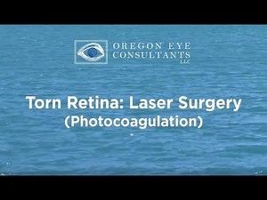 Torn Retina Photocoagulation Procedure