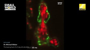 1K views · 35 reactions | The wait is over! The winners of the 2023 #NikonSmallWorldInMotion competition have been revealed. Check out the full video gallery here: https://bit.ly/3t8y9VA | Nikon Small World | Facebook