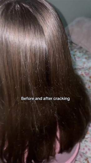 #funny #cracking #stayfreaky #fyp @brookie 🦄 | cracking bones