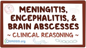 Meningitis, encephalitis and brain abscesses: Clinical: Video, Causes, & Meaning | Osmosis