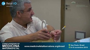 📌 Puesta al día del diagnóstico y manejo de patologías fetales (cardiopatías, defectos del SNC, gemelares, CIR) y del embarazo (preeclampsia, infecciones) con este curso dirigido por Eduard Gratacós • Ponencias en portugués y español • Algoritmos y protocolos de la medicina maternofetal aplicados a la práctica clínica • São Paulo • 8-10 noviembre • ¡¡ÚLTIMAS PLAZAS!! | Medicina Fetal Barcelona