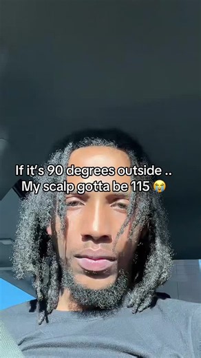 Locs Getting Thicker in Heat: How to Manage a Hot Scalp