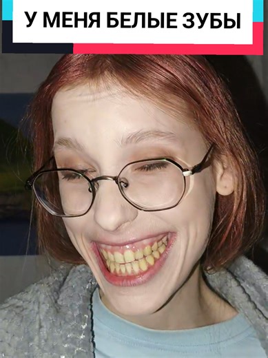 @raiaaa786 the trend of showing off your smile#beauty #fyp | Smile