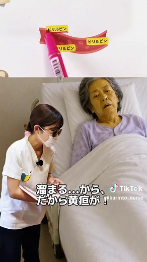 肝硬変の観察ポイントについて！ ※教育用画像使用しています ※動画時間の関係上、情報全てをお伝えすることはできません。ご了承ください 個人的見解もあります。 かりんとうナース 看護師14年目 ICU/一般病棟/ope室 急性期看護を発信中！