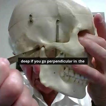 🦻 Why TMJ Inflammation Feels Like an Earache