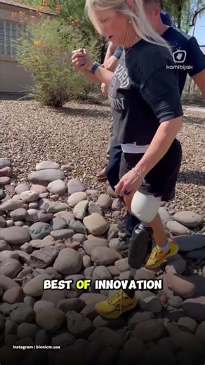The Bio Leg from Bionic M is one of the most advanced prosthetic innovations today. #kamibijakid