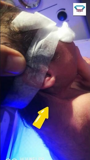 Noonan Syndrome | Neonatology | Doctor Xydi