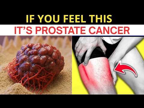 12 Silent Signs of Prostate Cancer You Should NEVER Ignore