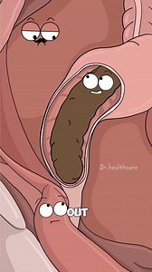 Why Poop Gets Stuck and the Toilet Footstool Fixes It? | Dr. Healthcare