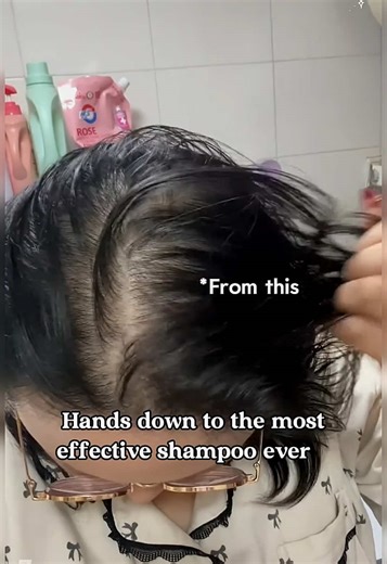 The Most Effective Shampoo for Hair Fall