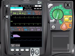Clinical Question of the Week: You have gained ROSC in your 72-year-old male patient. He was in coarse ventricular fibrillation. You shocked two times, administered 1 mg epinephrine 1:10000, and he is intubated. What is the next action you want to take? (Refer to video). We’ll post the answer in a few days! A. Check blood pressure B. Check ET cuff C. Start a chronotropic drip D. Obtain a 15-lead EKG | EMS World - Emergency Medical Services