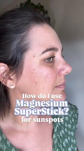 585K views · 185 reactions | Sunspots? Blemish? GONE. Say Goodbye to Sunspots & Blemishes + more! This tiny stick is a game-changer for your skin! • Draws out the root with high-potency magnesium • Dries, lifts and removes tags naturally Fast results | Sensitive skin friendly Ready to say goodbye? Shop now before it sells out again! | Downunder Magnesium | Facebook