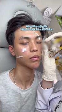 ✨ Cân chỉnh Ful Face – giúp gương mặt hài hoà & trẻ trung hơn✨ #haanhbeauty #fillerbotox