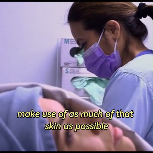 32K views · 153 reactions | Dr Pimple Popper An American Tail p02 #drpimplepopper | Terrence Battel | Facebook