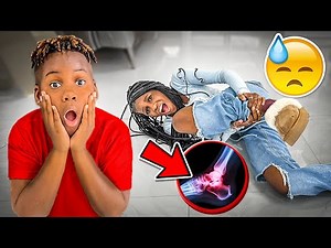 Clumsy Girl Breaks Her Leg Again While Trying To Learn A New Tik Tok Dance