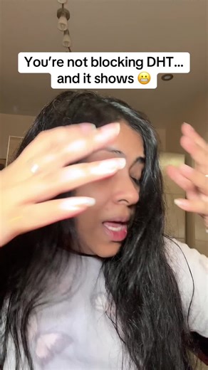 Natural Ways to Block DHT for Fuller Hair