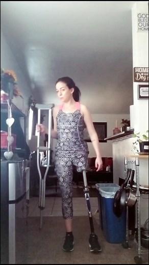 Adjusting to My New Prosthetic: A Hemipelvectomy Journey