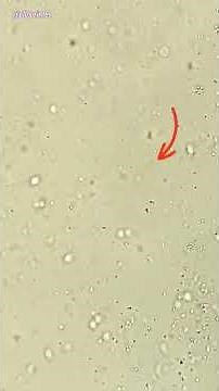 Raw Eggs Under Microscope (Chicken Egg)