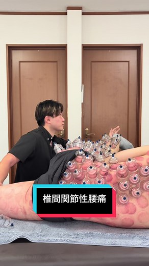 椎間関節性腰痛 足関節捻挫 今回は、バスケットボール選手の椎間関節性腰痛と足関節捻挫の治療を行いました！ カッピングよる筋緊張除去と、骨盤ストレッチ、クリームによる患部治療で痛みの除去と動作改善を行いました！ #整体 #鍼灸 #カッピング #バスケ #nba