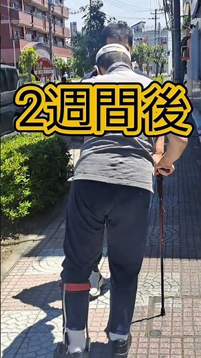 【片麻痺】2週間での歩行の変化。諦めないための歩行訓練