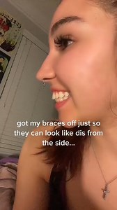 When your teeth are flared, it usually means something was missed #DentalTips #SmileMore #StraightTeeth #DentistHumor | TheBentistofficial