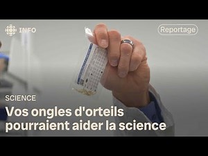 Toenails used as radon test