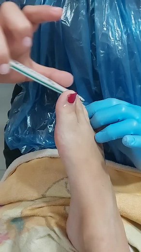 Nail Care Tips for Perfectly Polished Toenails