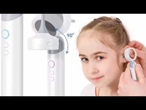 1.38” IPS Ear Camera 1080P | Portable Ear & Mouth Inspection Tool with 12 Tips