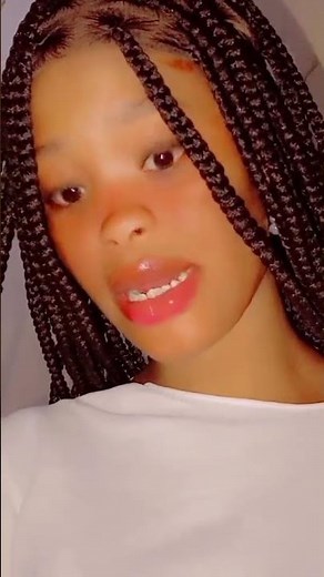 DAE amputee armless girl #DSD #noarms #doublearmamputee