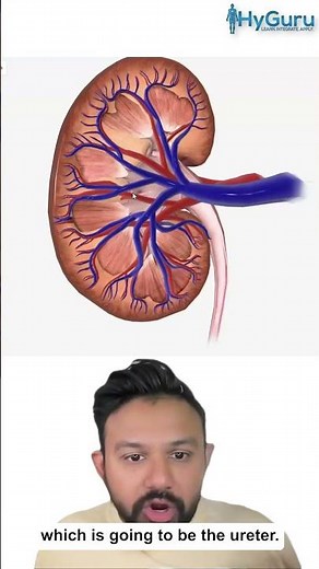 Renal Papillary Necrosis for the USMLE | HyGuru