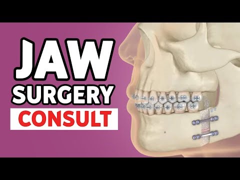 Jaw Surgery Consultation Explained: What to Expect