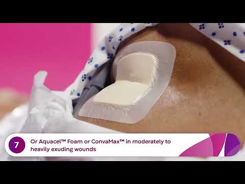 How to Apply and Remove Aquacel® Ag+ Ribbon (Cavity Wound)