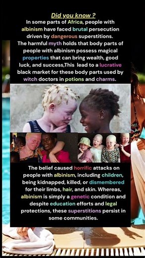 Albino Myths in Africa #albino #myths