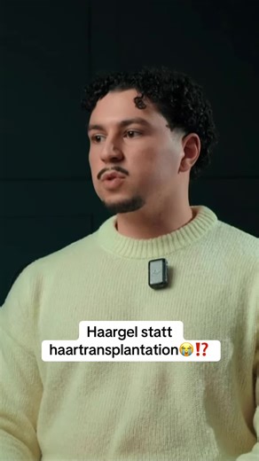 Haargel: Die Alternative zur Haartransplantation