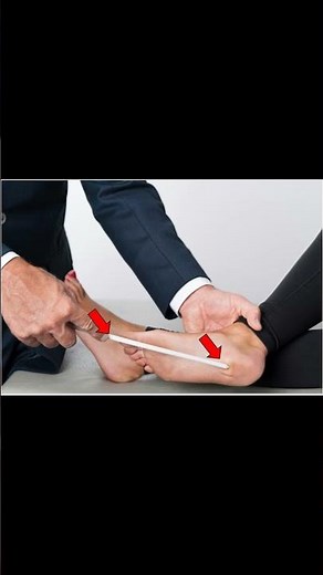 Babinski Reflex #neurology #meded #physiotherapy