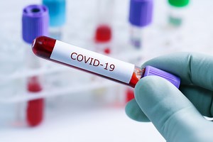 New COVID-19 case brings district total to 63
